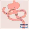 Cochrane review: Uncut Roux-en-Y reconstruction after distal gastrectomy for gastric cancer
