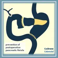 Duct‐to‐mucosa versus other types of pancreaticojejunostomy