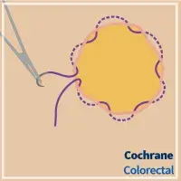 Cochrane review: Purse‐string skin closure versus linear skin closure in people undergoing stoma reversal