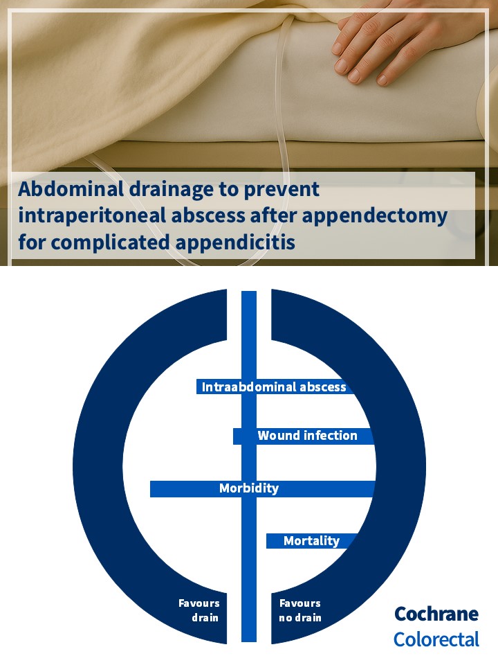 Cochrane review: Abdominal drainage to prevent intraperitoneal abscess after appendectomy for complicated appendicitis