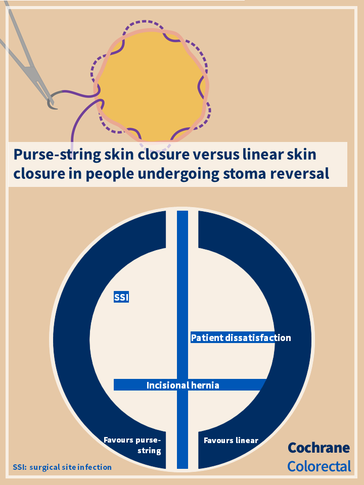 Visual abstract for Cochrane review: Purse‐string skin closure versus linear skin closure in people undergoing stoma reversal