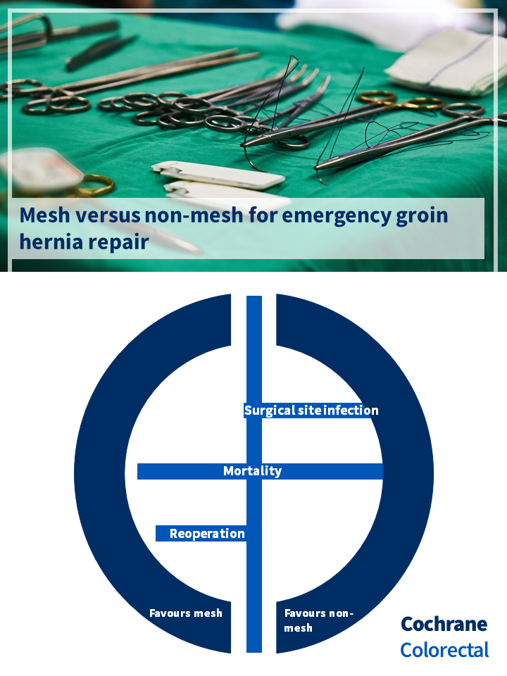 Visual abstract for the Cochrane review: Mesh versus non‐mesh for emergency groin hernia repair 